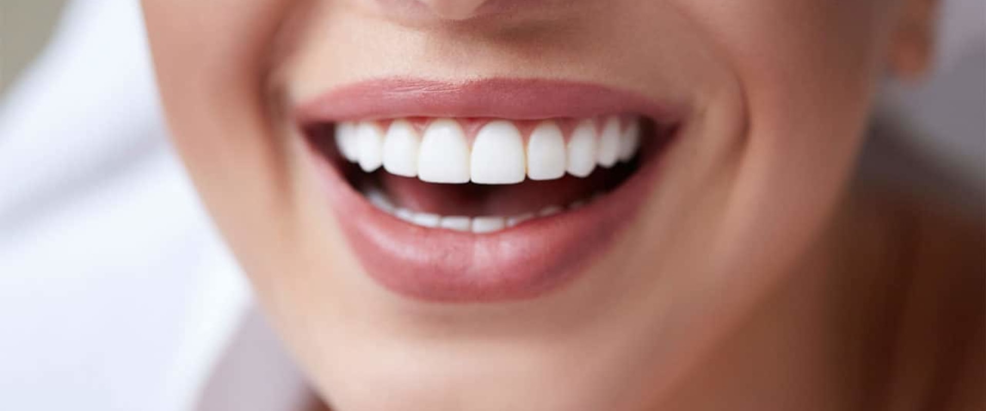 Are Veneers Worth It? A Comprehensive Guide