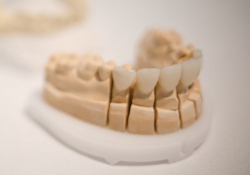 The Pros and Cons of Dental Veneers